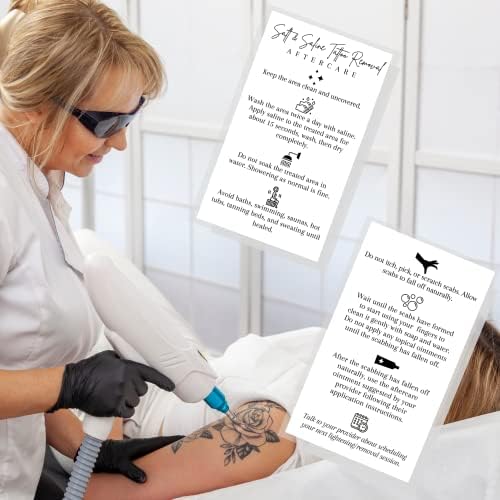 Só & Sós Tetoválás Eltávolítása teendőkről | 50 Csomag | Méret 2x3.5 - os Üzleti Méretű Kártya | Biztonságos Tetoválás Villám